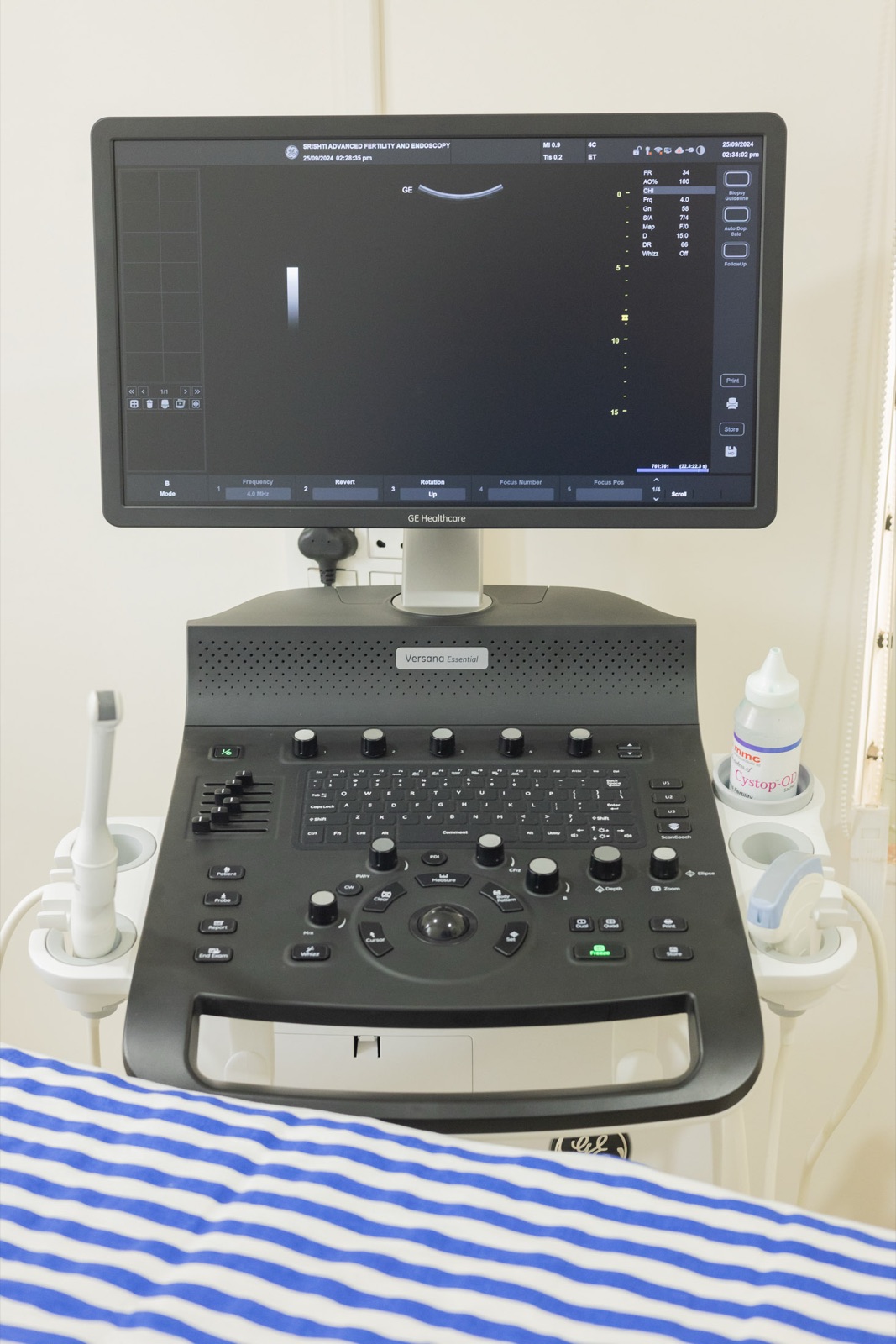 GE Healthcare ultrasound system at Srishti SAFE used for fertility investigations